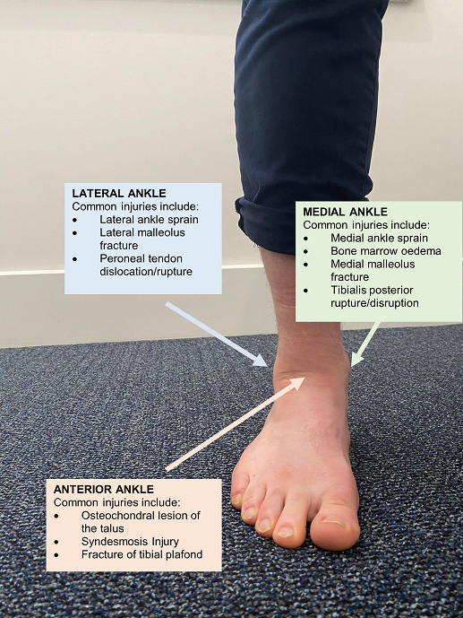 common-ankle-injury-location